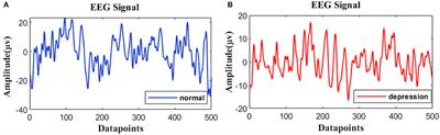 SparNet: A Convolutional Neural Network for EEG Space-Frequency Feature Learning and Depression Discrimination